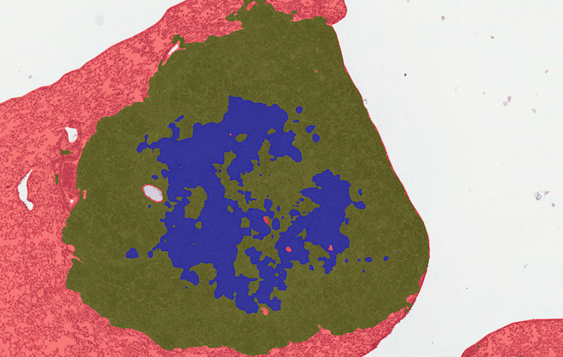 Tufts University case study: enhancing tuberculosis research with AI