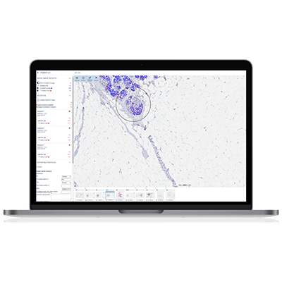Clinical_Ki67_tab