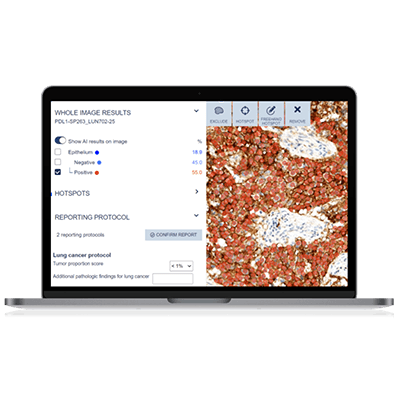 Clinical_PDL1_tab