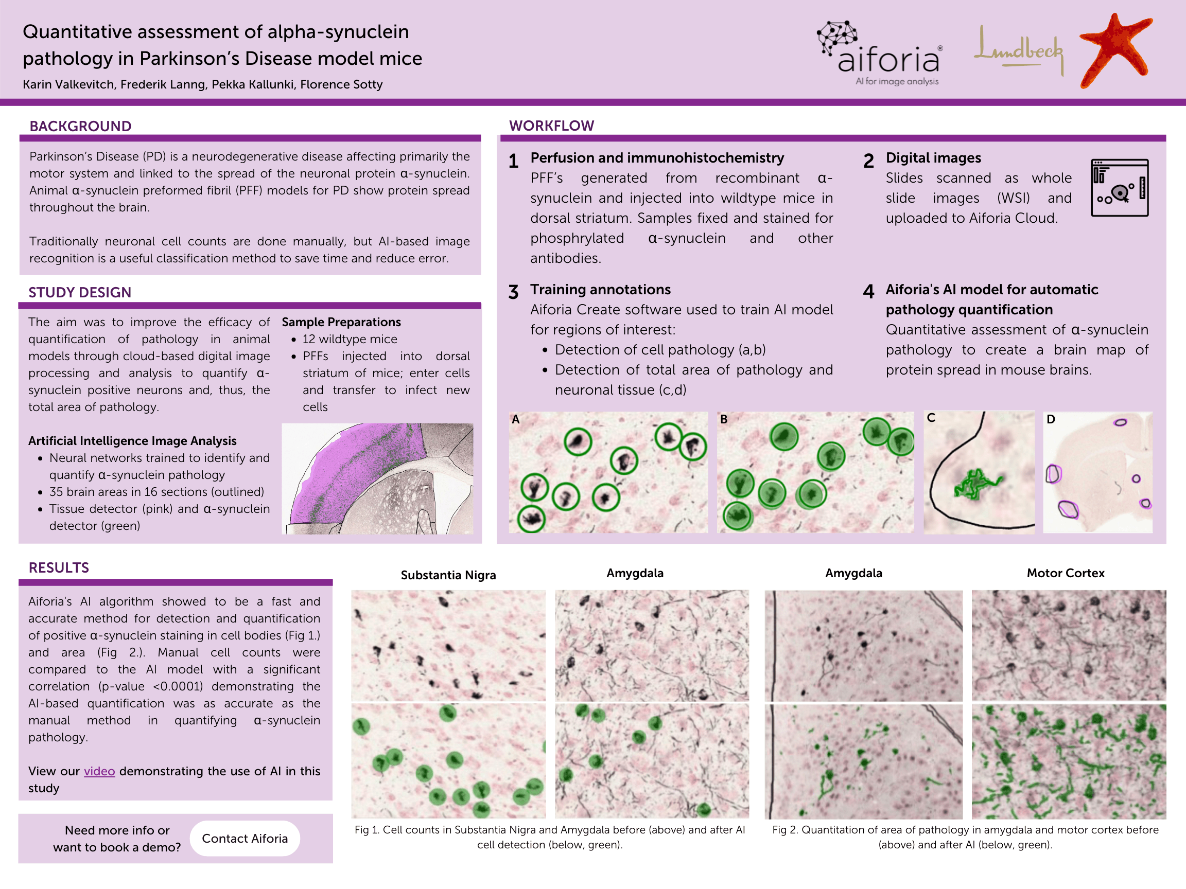 Lundbeck  alpha-synuclein infographic