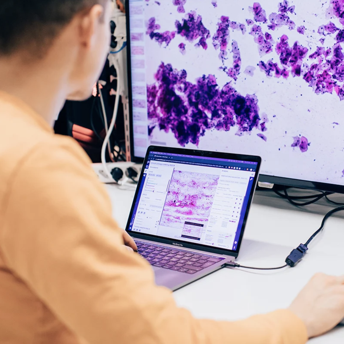 Introduction to AI in digital pathology