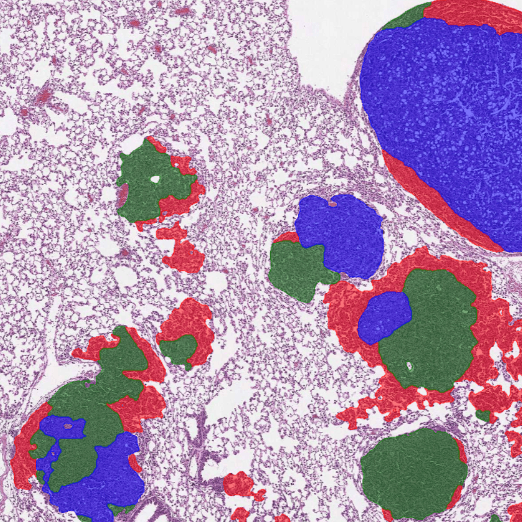 AI for histopathological analysis of murine lung tumors