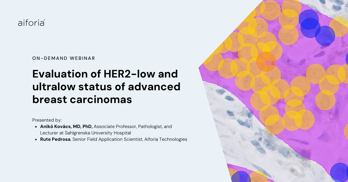 Webinar | Evaluation of HER2-low and ultralow status of advanced breast ...