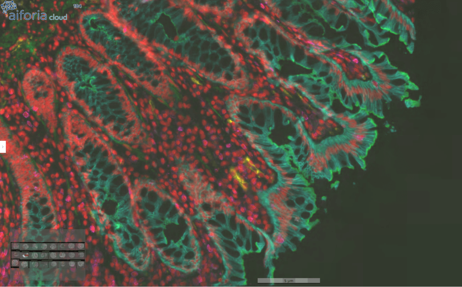 Immune Cells in Human Colon